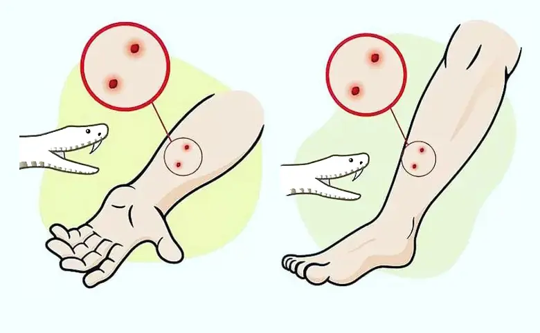 Bi.tten by a Snake? Here’s the First Thing You Must Do — It Could Save Your Life