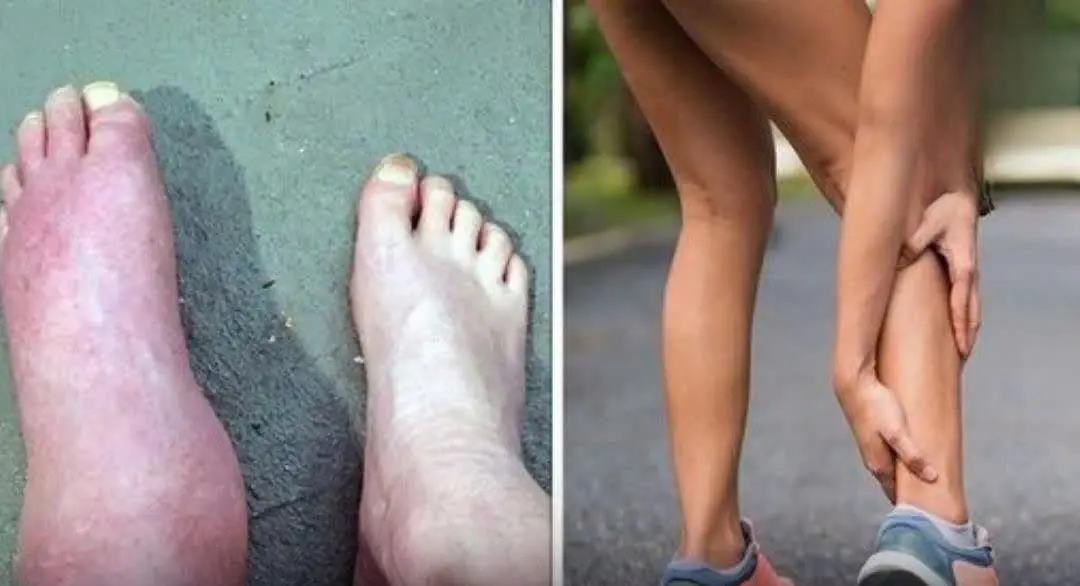 The Foot Symptom That Signals the Damage May Be Irreversible