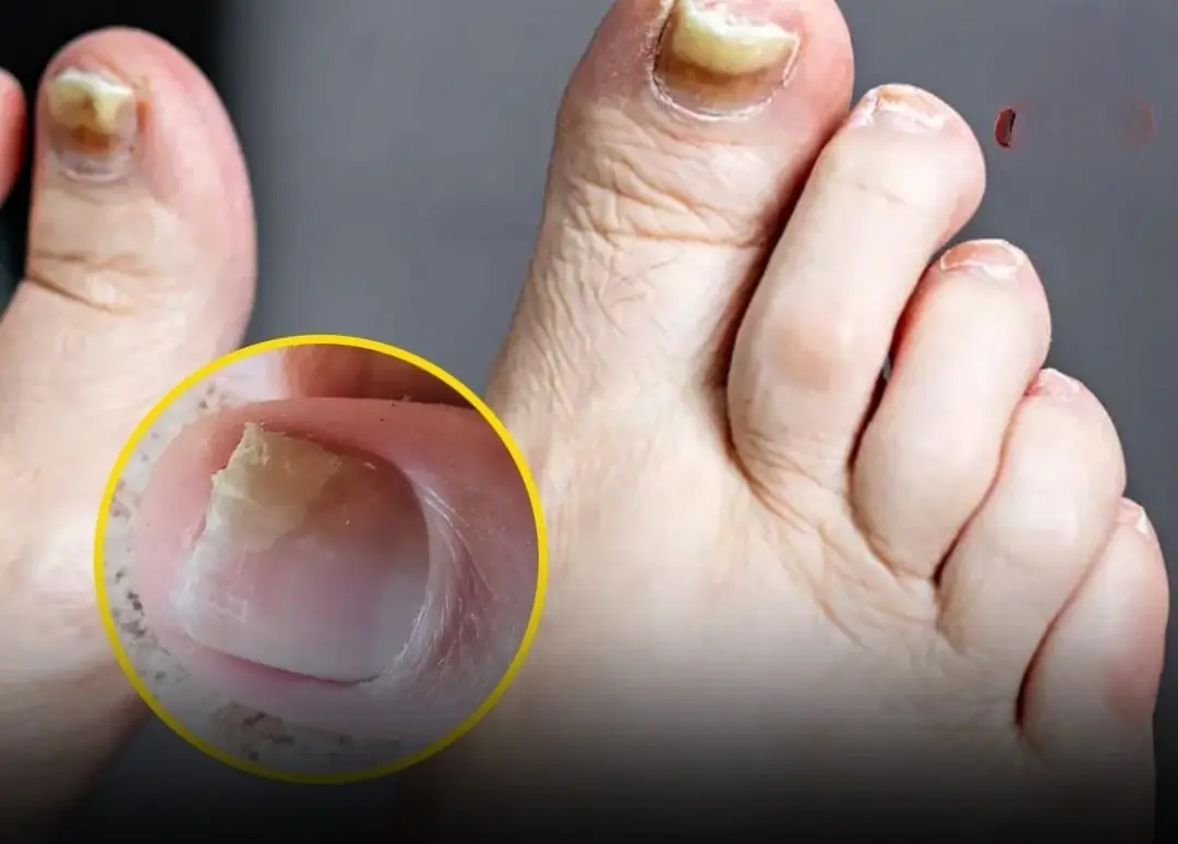 Doctors Warn: Two Foot Symptoms That May Reveal a Silent Kil:ler