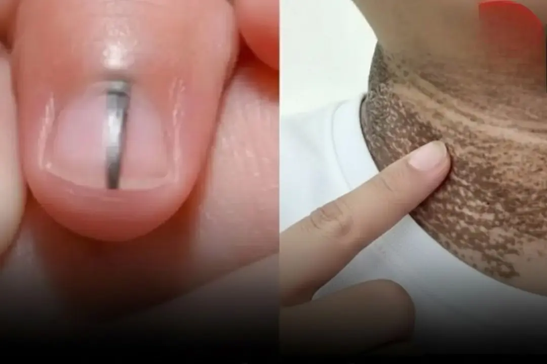 5 warning signs that can.cer may be coming but few people notice