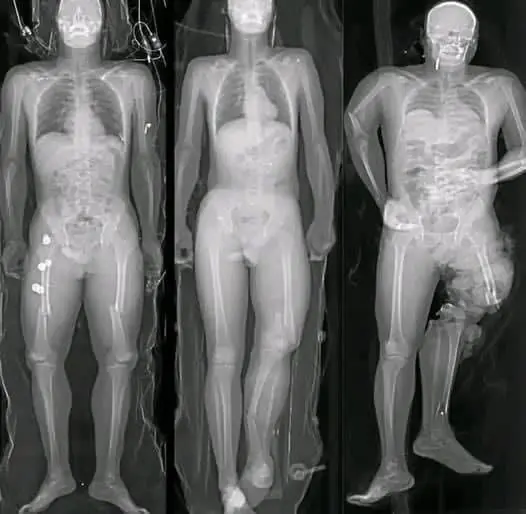 What You Need to Know After You’ve Received the Vaccine