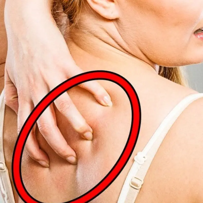 8 Signs You Have Too Much Sugar in Your Body