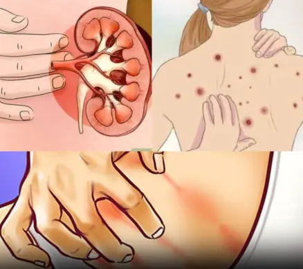 10 Early Signs That Your Kidneys Might Not Be Working Properly