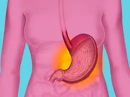 What Could Occur If a Gastric Balloon Br.eaks Inside the Stomach?