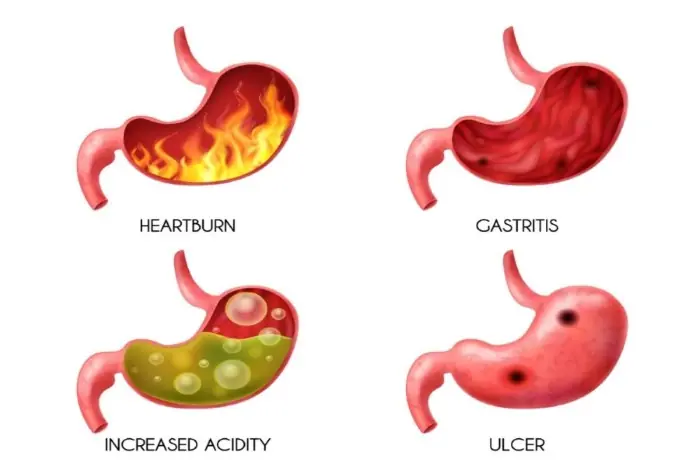 9 Proven Natural Ways to Manage Acid Reflux at Home