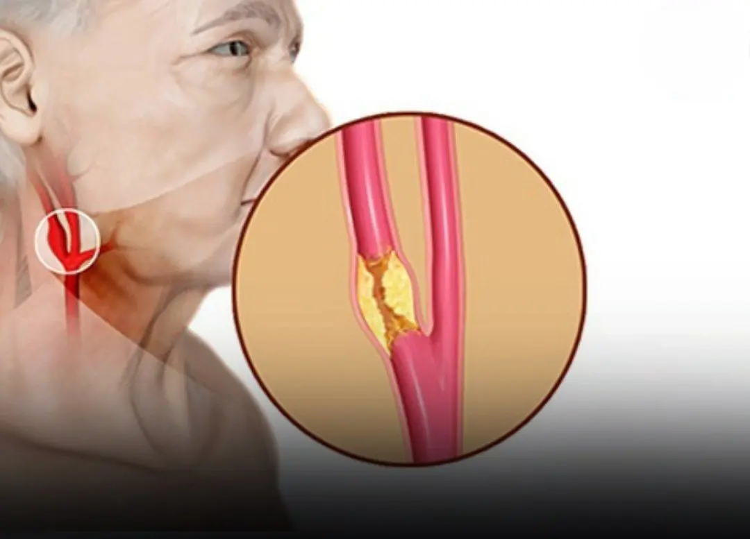 6 Evidence - Based Ways to Support Healthy Arteries