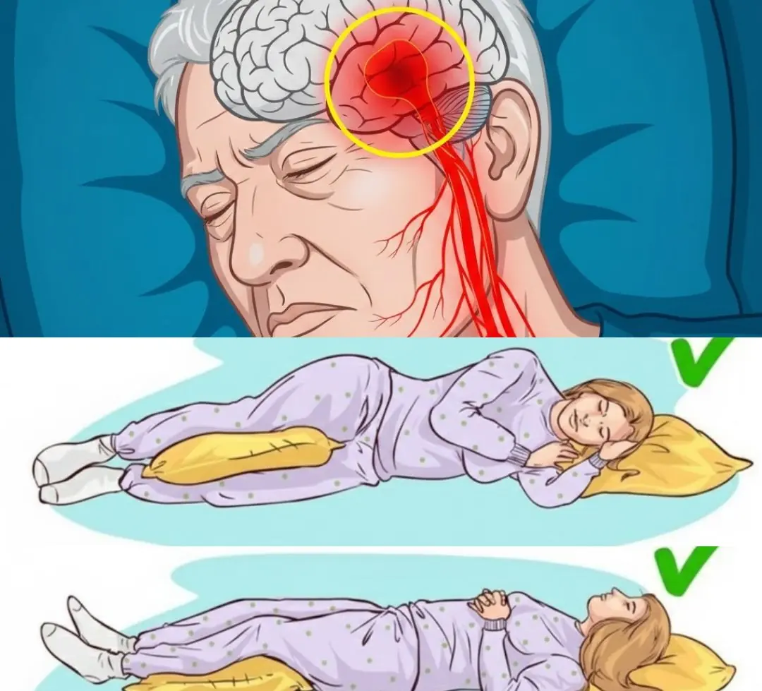 SENIORS: This Sleeping Position Raises Your Stroke Risk