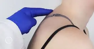 That Neck Hump Might Mean More Than Bad Posture — 5 Ways to Reverse It