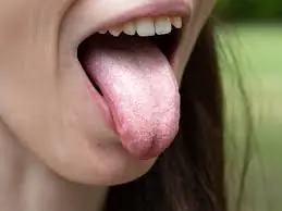 Do You Wake Up with Dry Mouth? These 9 Causes Might Surprise You