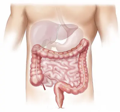 5 Silent Warning Signs of Colon Cancer You Shouldn’t Ignore