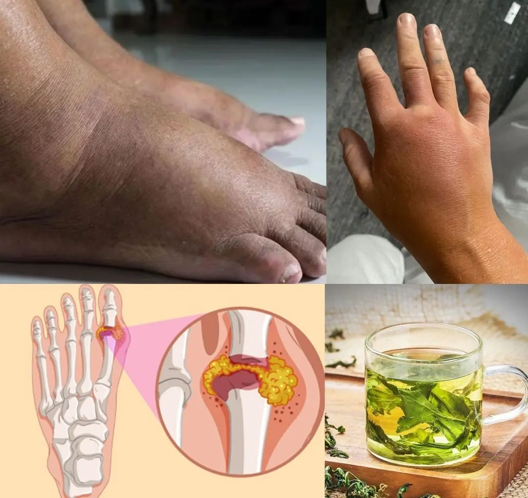 Drink this tea and say goodbye swollen legs, ankles or feet again