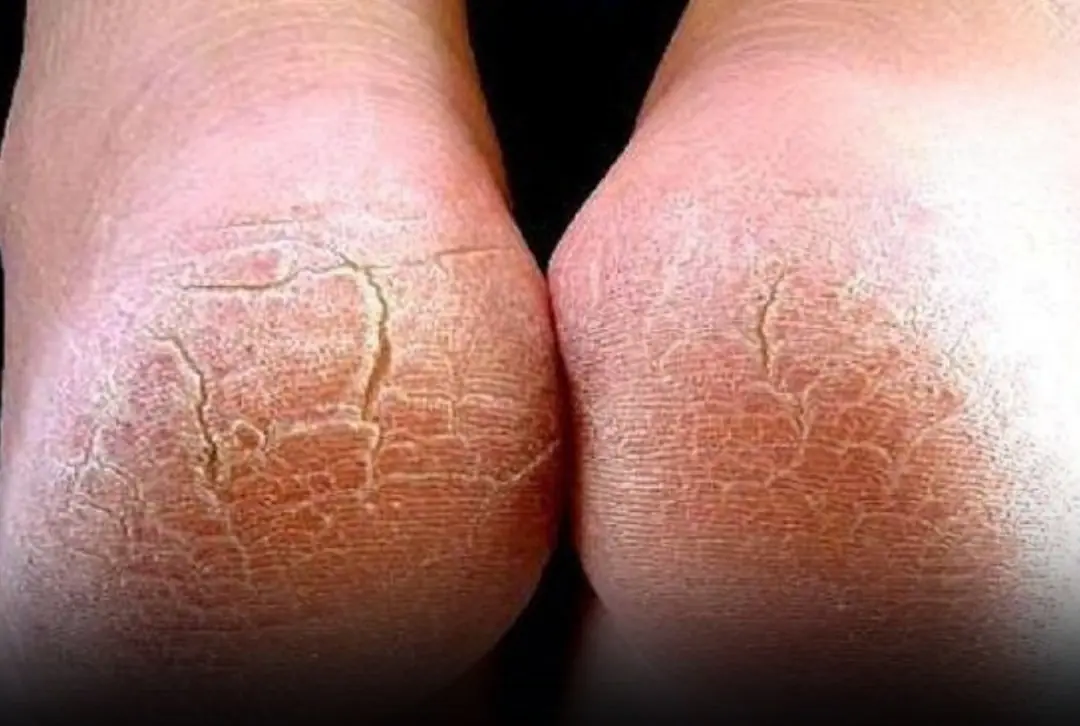 A Pharmacist Says It Could Be Something Serious