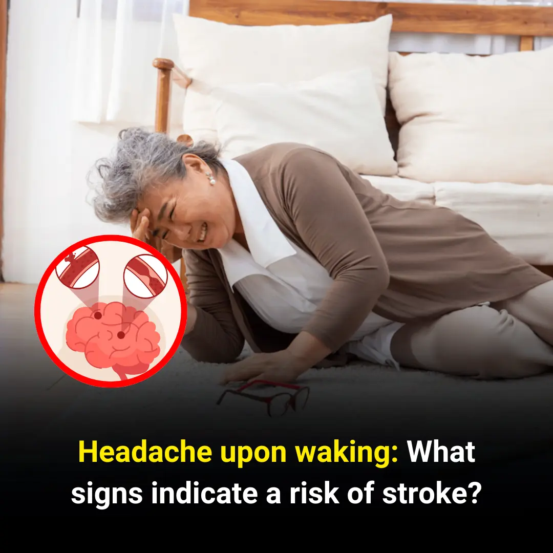 Morning Headache? These Signs Could Mean Stroke Risk