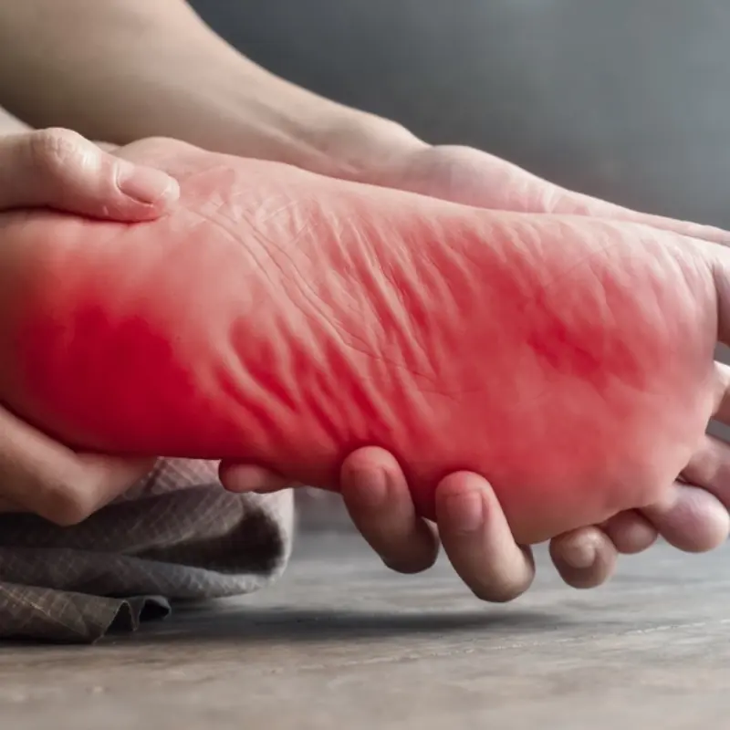 10 Diabetes Symptoms That May First Appear in Your Feet