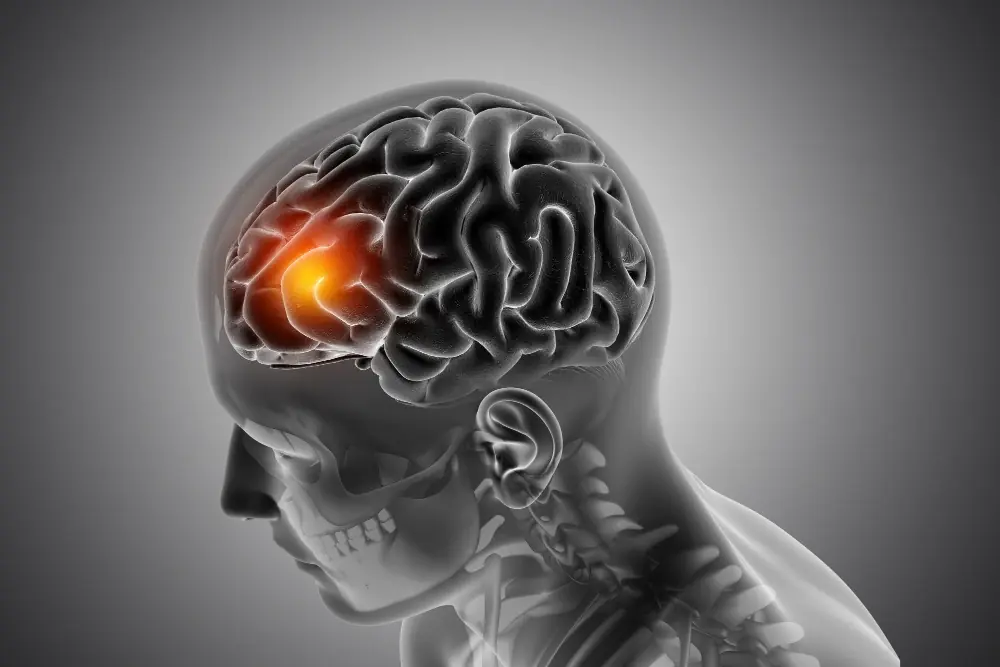 A Month Before a Stro.ke, Your Body May Send Warning Signals: 10 Signs You Should Never Ignore
