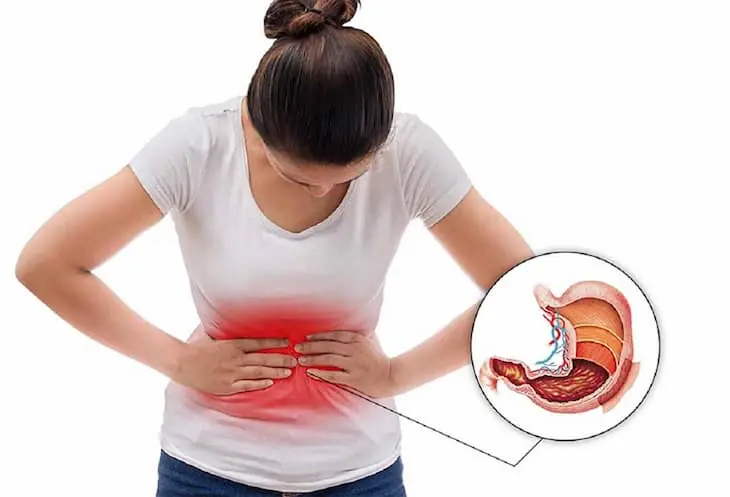 Umbi.lical hernia: What causes it, common symptoms and treatment options