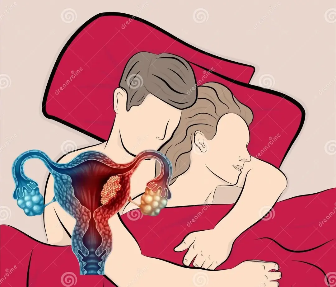 Husbands With These Habits May Put Their Wives at Higher Risk of Can:cer - Stop Them Now