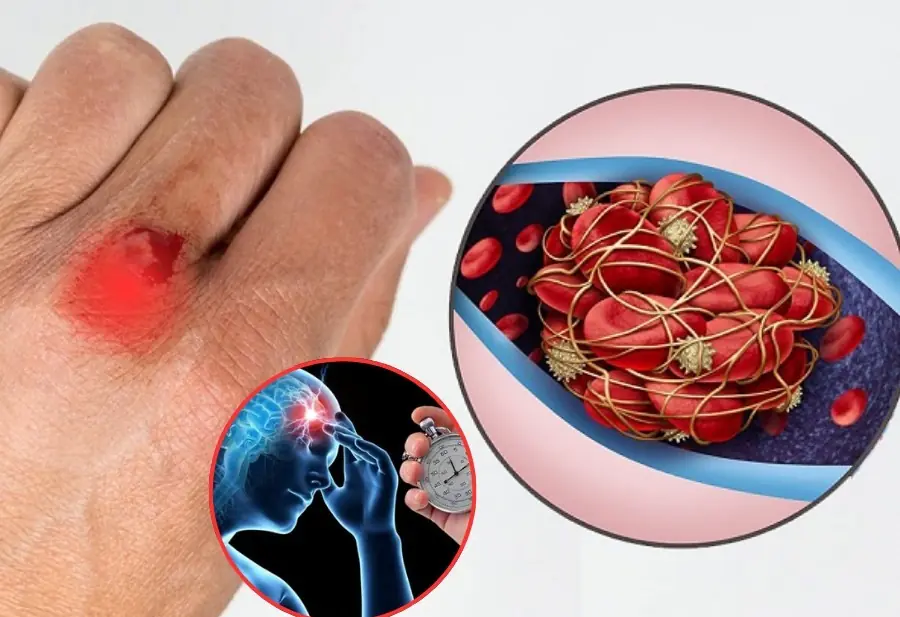 Stroke rarely comes without warning — these 9 silent brain clot signs can appear weeks earlier