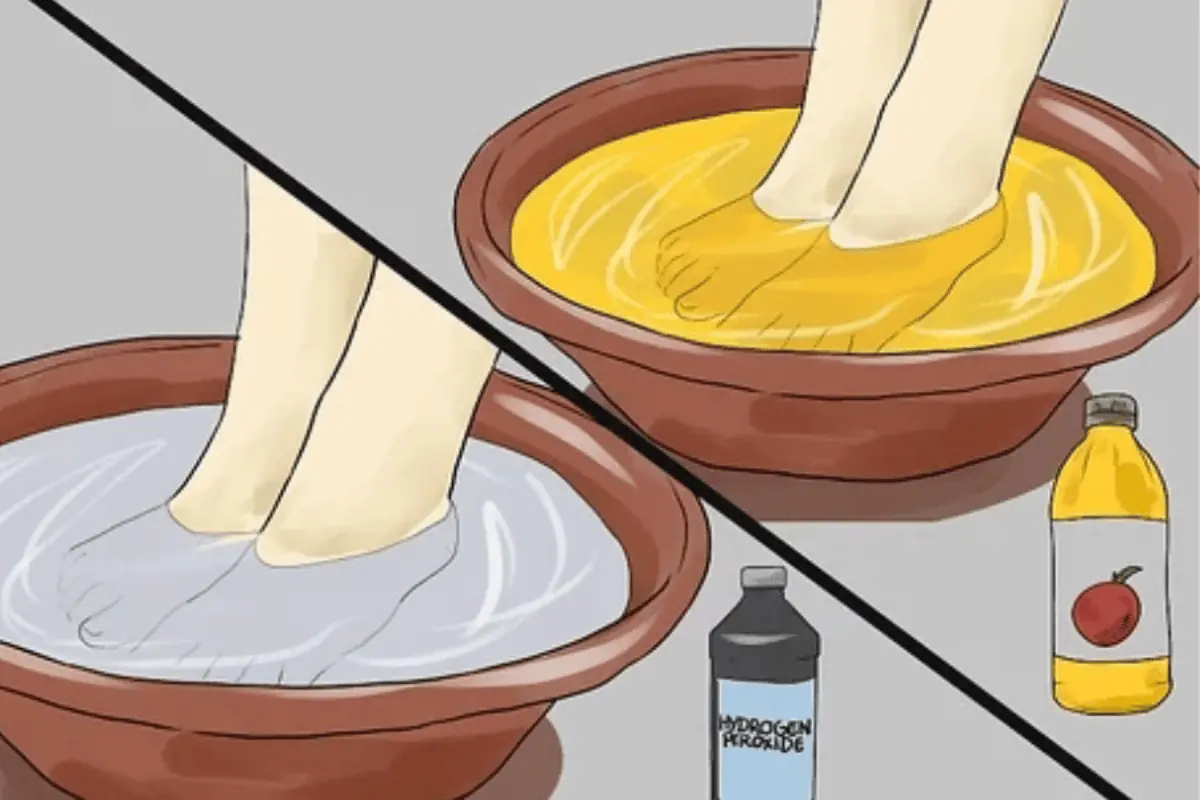 What Happens When You Soak Your Feet in Apple Cider Vinegar?