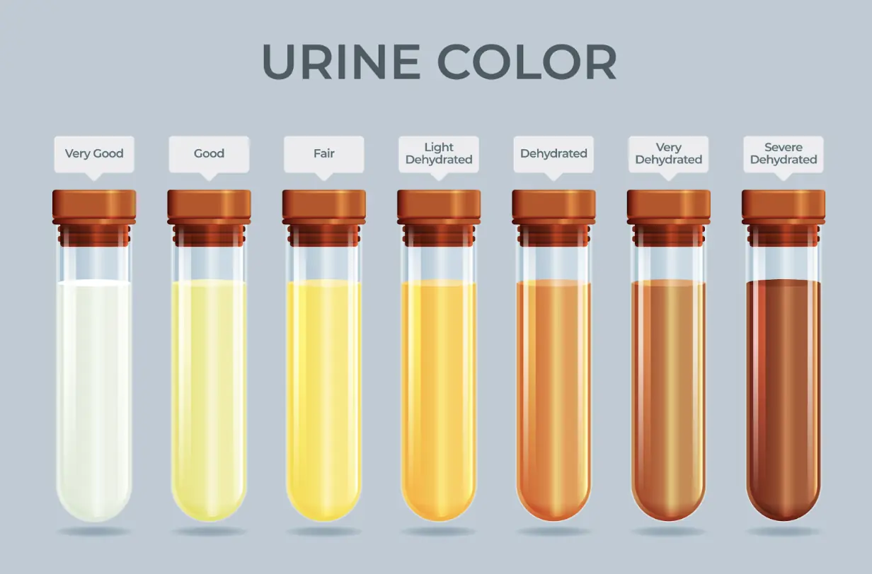 The Hidden Health Messages in Your Urine Color