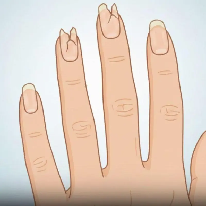 Are Your Nails Always Splitting or Breaking? Here’s What Your Body Is Trying to Tell You