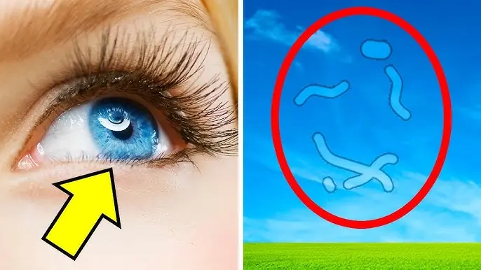 Eye Doctor’s Advice: What to Do When You Start Seeing Floaters