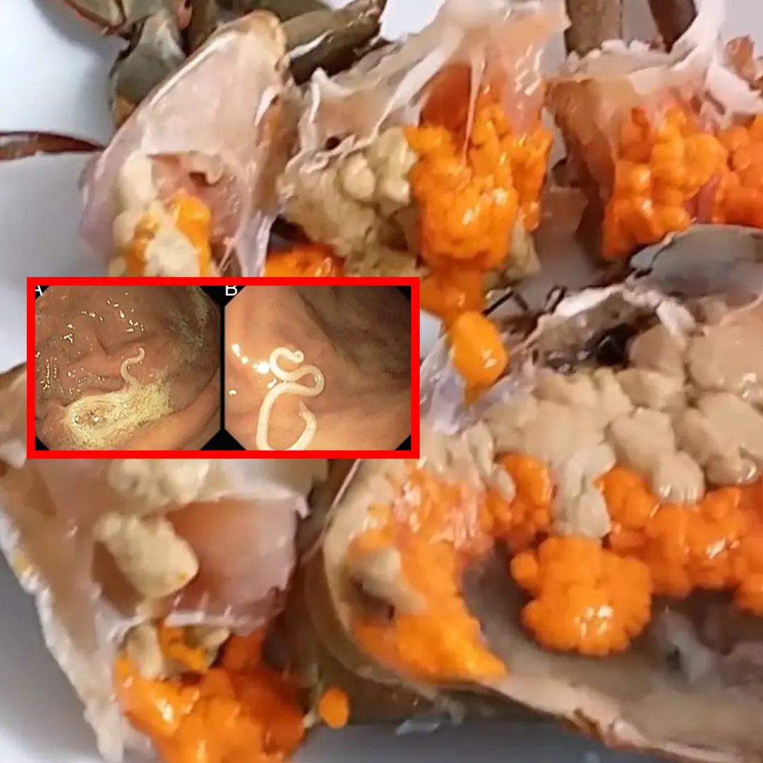 Avoid These 4 Foods That Could Contain Parasites, Doctors Warn