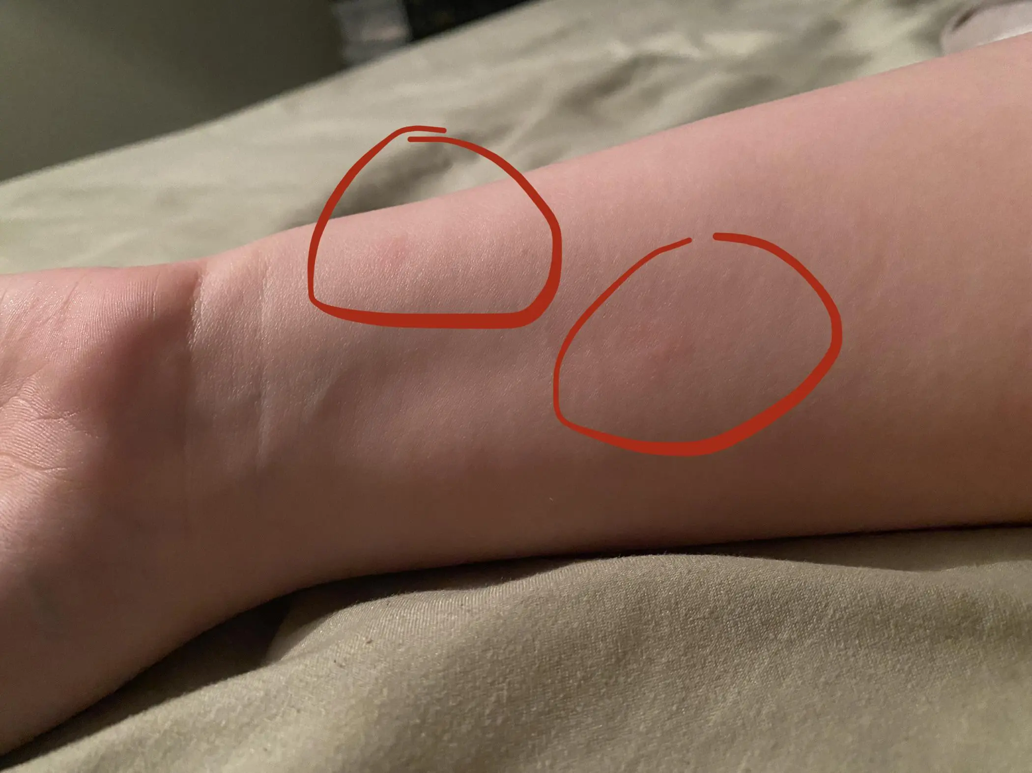 Don’t Ignore Itchy Skin and Strange Bumps — Here’s What They Could Mean