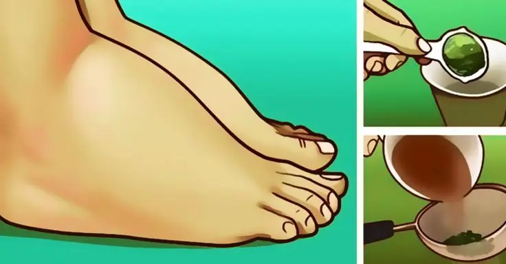 These Simple Recipes May Help Reduce Water Retention and Swelling