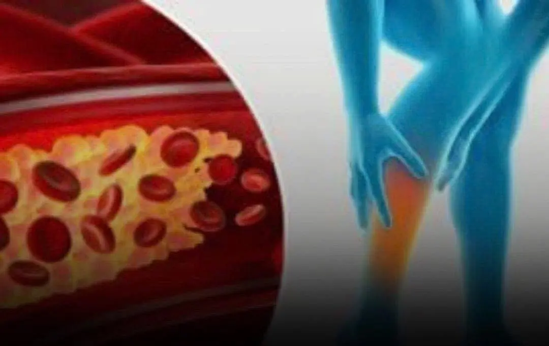 "Your feet could be signaling that your arteries are clogged."