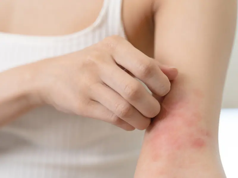 If these 2 areas of your body it.ch frequently - It might not just be an all.ergy