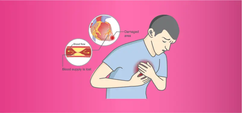 10 Warning Signs of Stroke and Early De:ath During the High-Risk Years of Ages 46–55