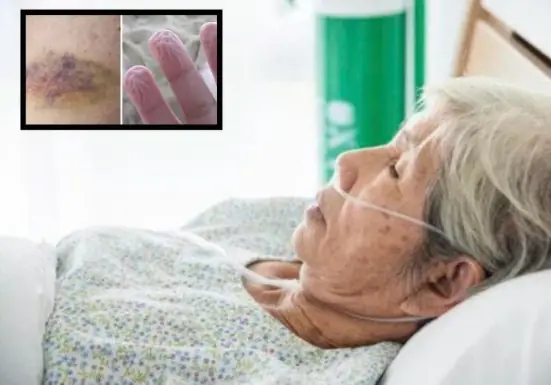 6 Signs That May Indicate the Body Is Approaching the Final Stage of Life