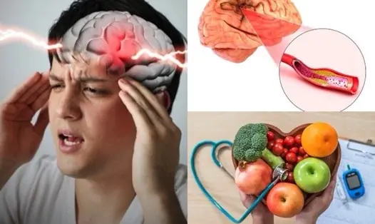 Eating for Str.oke Prevention: 10 Foods You Shouldn’t Ignore