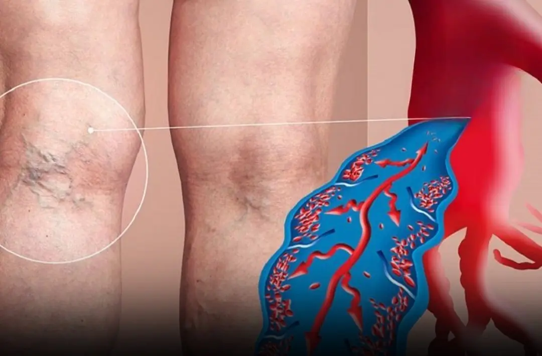 Do These 6 Simple Things Before It Gets Worse