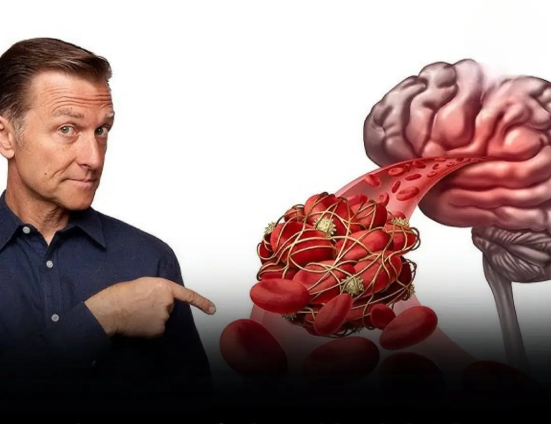 9 Silent Warning Signs of a Brain Blo:od Clot