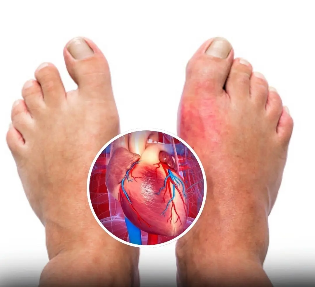 One Month Before a Heart Attack, Your Body May Warn You With These 7 Signs