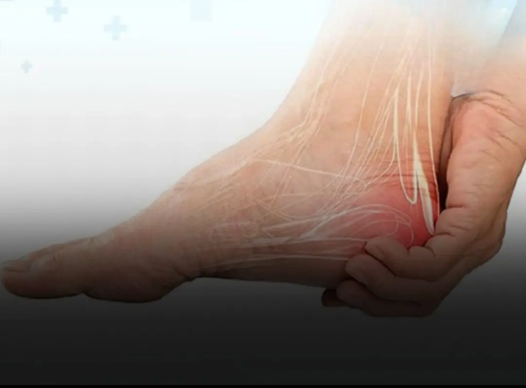 If Your Heel Hurts When You Wake Up or After Standing for a Long Time