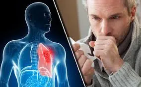 Don’t Ignore These 4 Morning Symptoms—Doctors Say They Could Signal Lung Cancer Progression