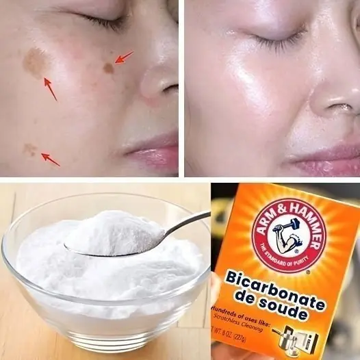 4 Ways to Reduce Age Spots with Baking Soda for Brighter, More Even Skin