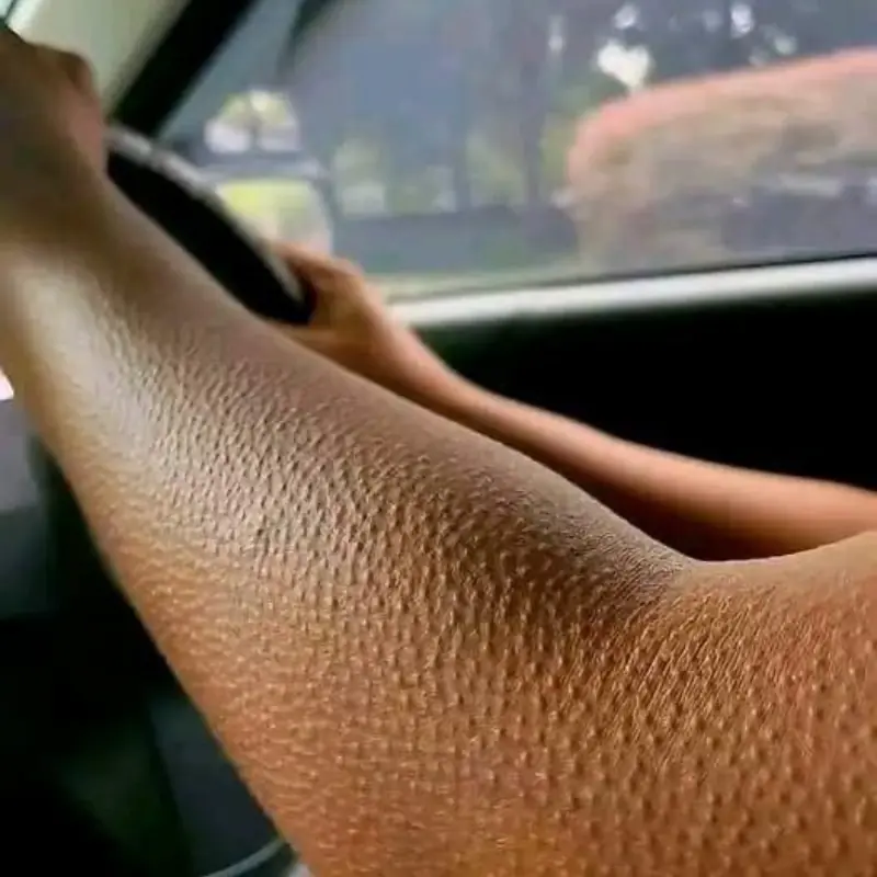 If Your Skin Looks Like This, Here’s What It May Really Mean