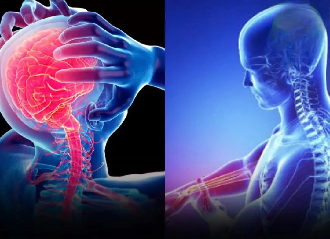 These are the symptoms nearly half of str:oke patients feel days before the att:ack