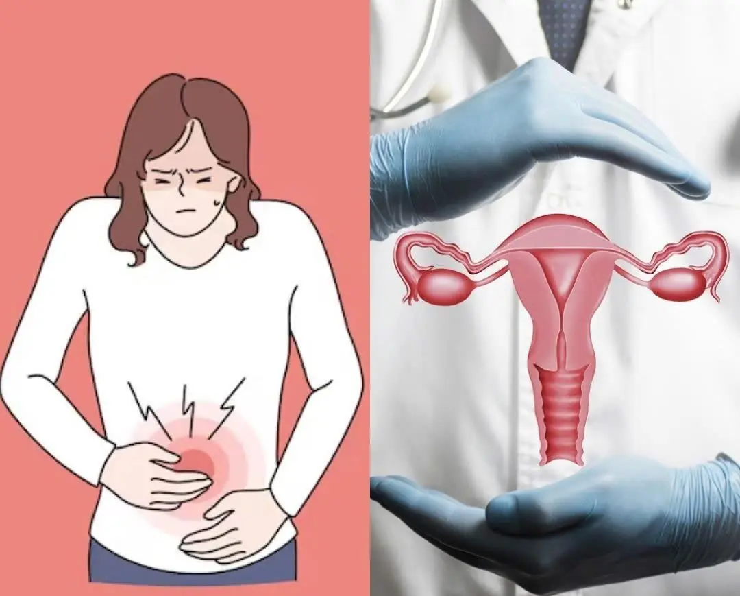 8 Early Warning Signs of Ovarian Cancer That Many Women Ignore