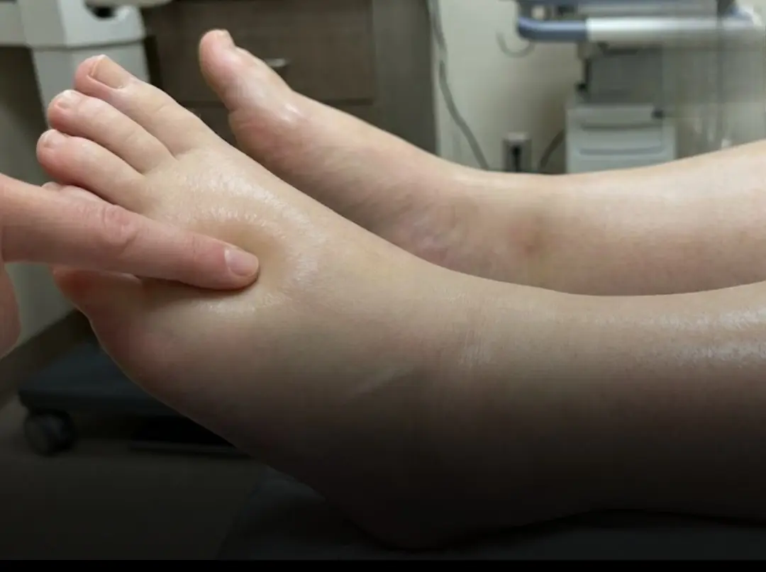 Effective Ways to Reduce Water Retention Naturally