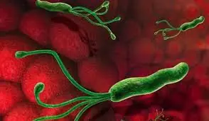 The Real Cause of Bloating and Heartburn — And What You Can Do About It