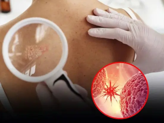 Don’t Ignore These 20 Early Warning Signs That Your Body Could Be Fighting Can:cer