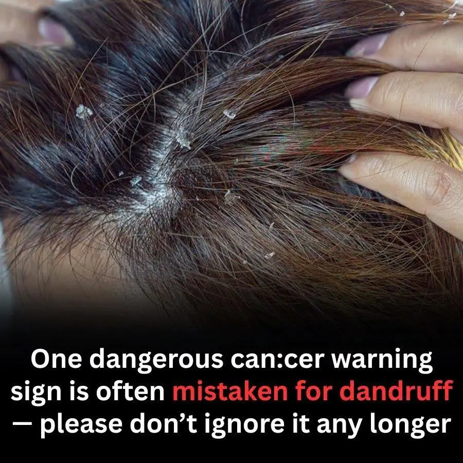 Notice This Sign Early — It Could Make a Big Difference