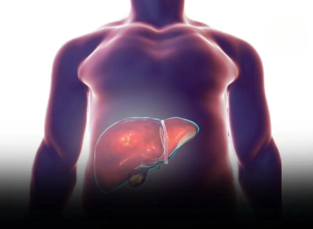 How to Know Whether a Protruding Belly Is Fat or a Sign of Liver Problems