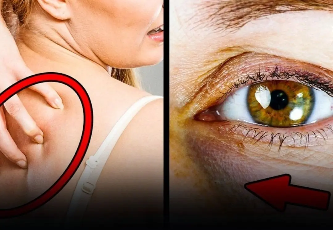 5 Signs Your Body May Be Warning You That You’re Consuming Too Much Sugar