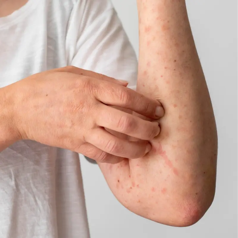 Early Warning Signs Your Body May Be Sending About Kidney Problems